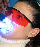 Load image into Gallery viewer, LED Teeth Whitening Machine ONLY

